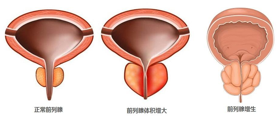 前列腺凝膠廠家.png