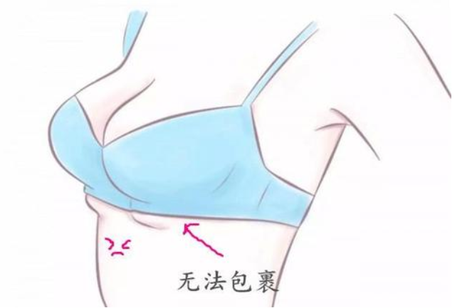 乳腺凝膠貼牌加工.png