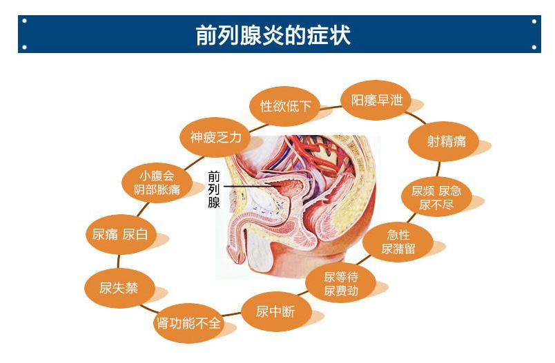 前列腺貼生產(chǎn)廠家