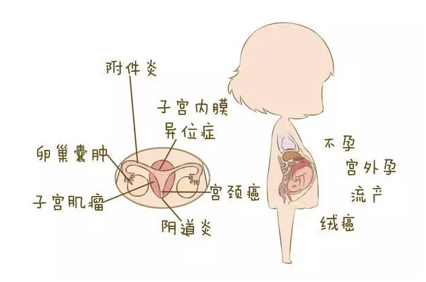 婦科凝膠OEM