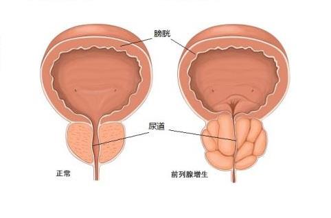 前列腺貼牌廠家