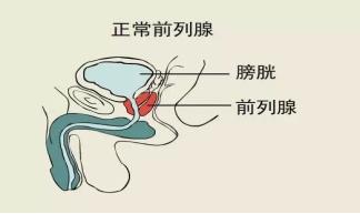 前列腺凝膠oem廠家