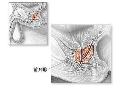 前列腺凝膠代加工廠(chǎng)家