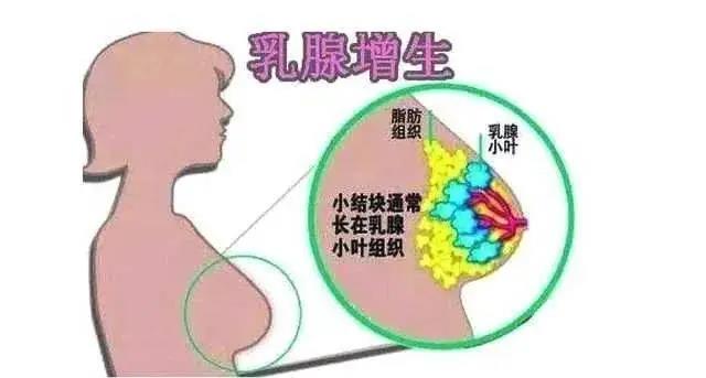 乳腺膏貼牌廠家