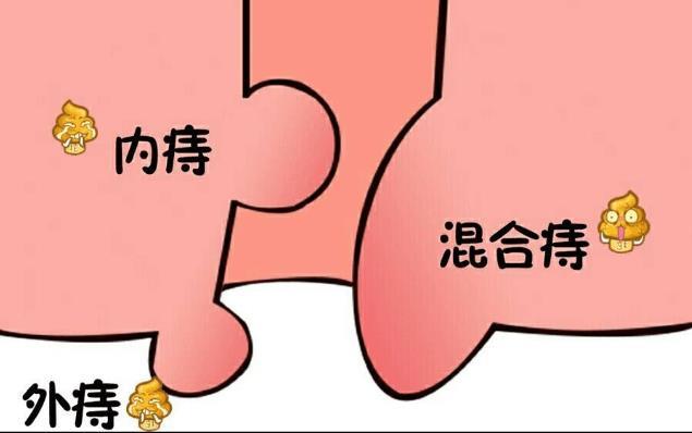 痔瘡凝膠定制廠家