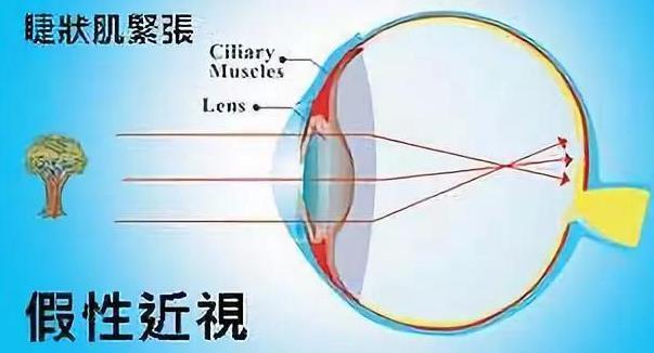 滾珠護眼膏廠家