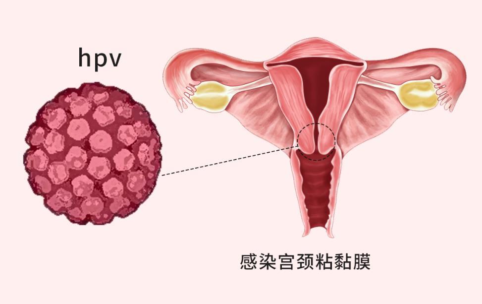 婦科凝膠OEM廠家