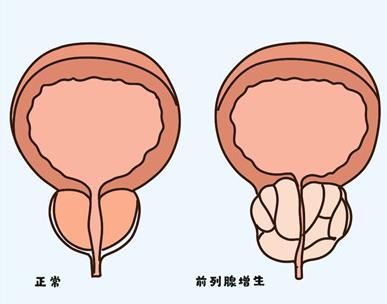 前列腺凝膠工廠